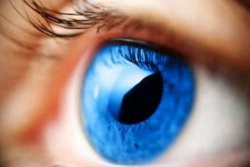 Glaucoma
